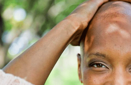 Cette chanteuse TRÈS connue au Québec a le cancer et elle n’a plus un sou!!! Mélanie Renaud