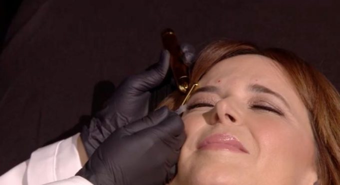 julie snyder injection botox