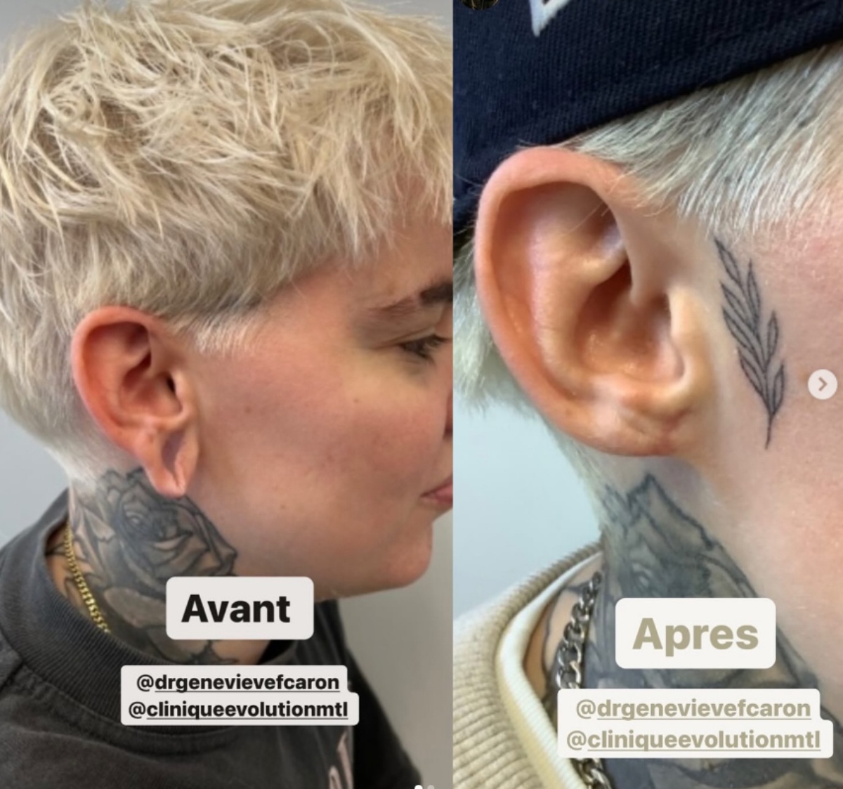 oreille roxane bruneau