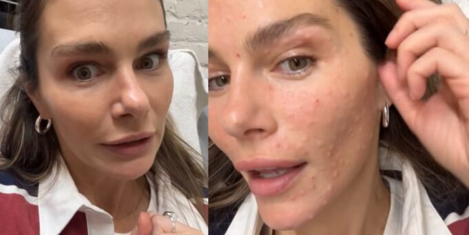 Maripier Morin montre le résultat après son traitement au visage