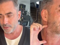 L’animateur Benoît Gagnon annonce qu’il a un problème de santé